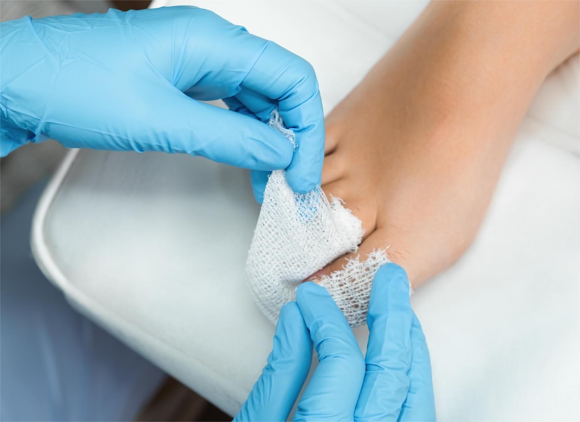 Nail Reconstruction