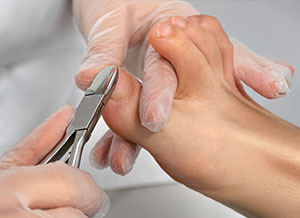 Routine Chiropody